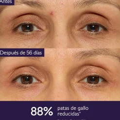 El Contorno de Ojos