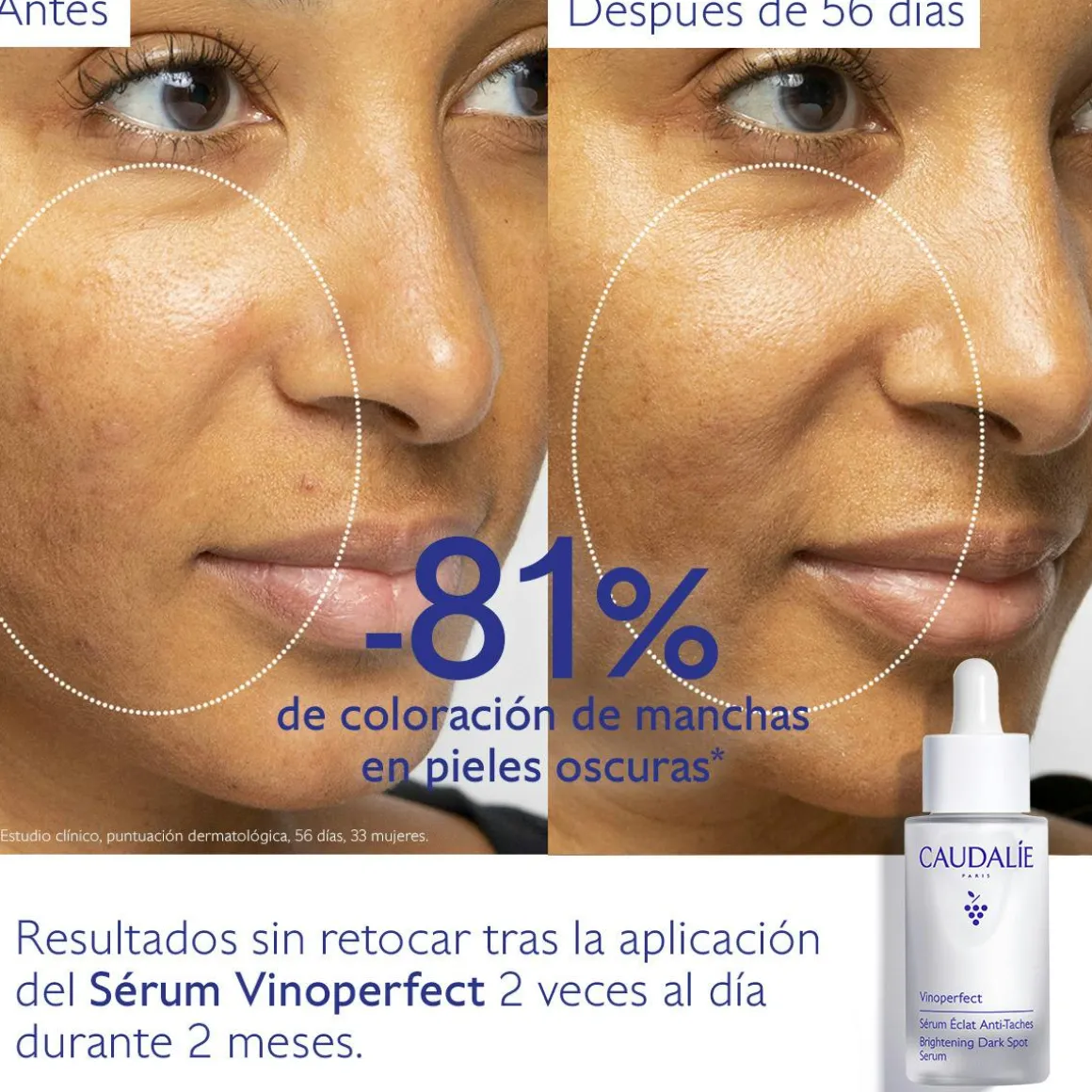 Sérum Resplandor Antimanchas con Viniferine, Alternativa a la Vitamina C - 30ml