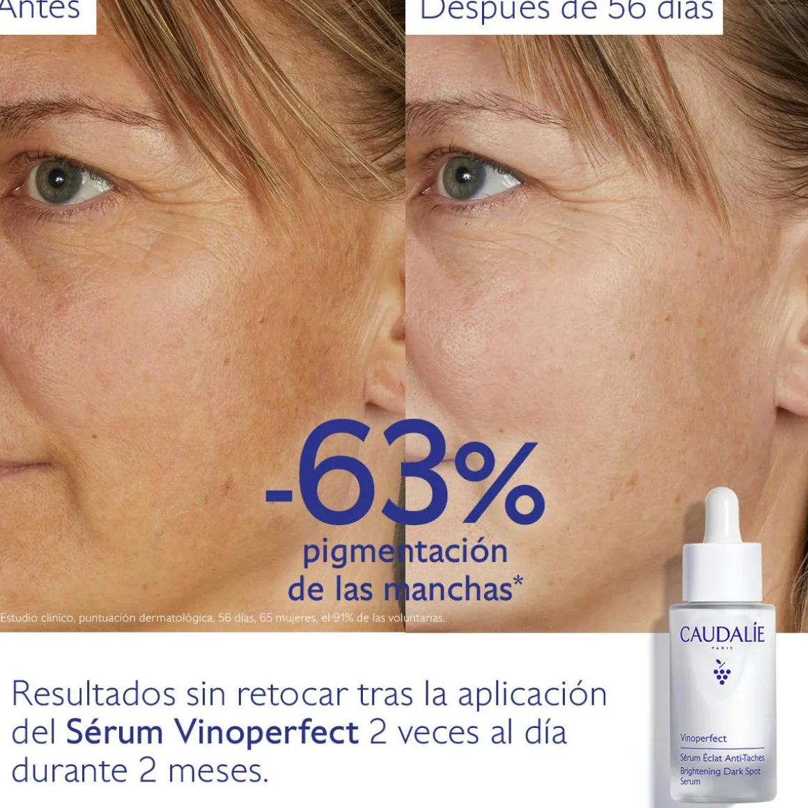 Sérum Resplandor Antimanchas con Viniferine, Alternativa a la Vitamina C - 30ml